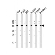 WB analysis of (1) HeLa whole cell lysate, (2) K562 whole cell lysate, (3) 293 whole cell lysate, (4) human testis lysate, (5) human brain lysate, and (6) human kidney lysate (20 µg/lane, predicted band size: 58 kDa).