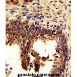 Keratin, Type II Cytoskeletal 4 (KRT4) Antibody