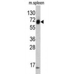 Keratin, Type II Cytoskeletal 4 (KRT4) Antibody