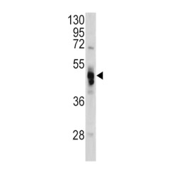 Galactosidase Alpha (GLA) Antibody