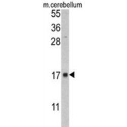 FK506 Binding Protein 2 (FKBP2) Antibody