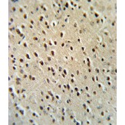 Hypoxanthine Phosphoribosyltransferase 1 (HPRT1) Antibody