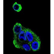 Alcohol Dehydrogenase 1B (ADH1B) Antibody