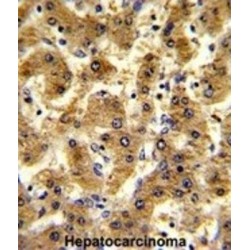 Alcohol Dehydrogenase 1B (ADH1B) Antibody