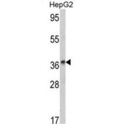 Alcohol Dehydrogenase 1B (ADH1B) Antibody