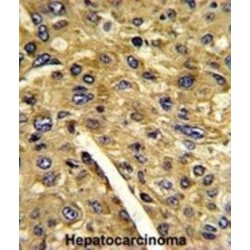 Aminomethyltransferase, Mitochondrial (AMT) Antibody