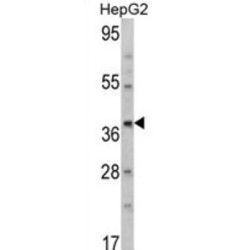Aminomethyltransferase, Mitochondrial (AMT) Antibody