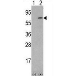 Macrophage Colony-Stimulating Factor 1 (CSF1) Antibody