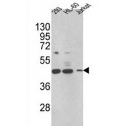 3-Keto-Steroid Reductase (HSD17B7) Antibody
