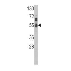 Interleukin 17 Receptor B (IL17RB) Antibody