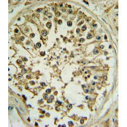 Proto-Oncogene Wnt-1 (WNT1) Antibody