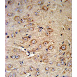 Corticotropin Releasing Hormone Receptor 2 (CRHR2) Antibody