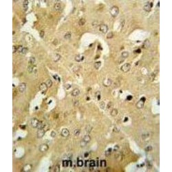 Corticotropin Releasing Hormone Receptor 2 (CRHR2) Antibody