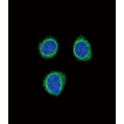 Endothelin Receptor Type B (EDNRB) Antibody
