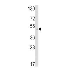 Endothelin Receptor Type B (EDNRB) Antibody