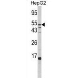 Tissue Alpha-L-Fucosidase (FUCA1) Antibody