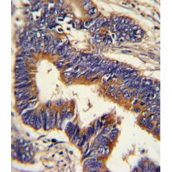 Glucagon (GCG) Antibody