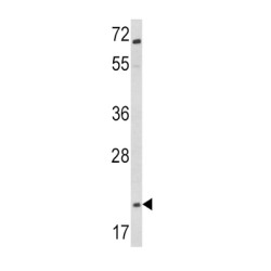 Glucagon (GCG) Antibody