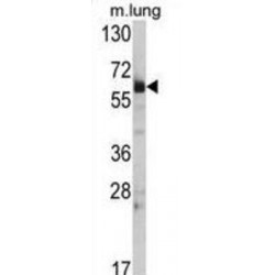 Heat Shock Protein HSP60 (Hsp 60) Antibody