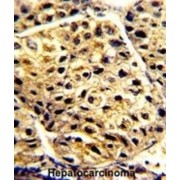 abx032997
