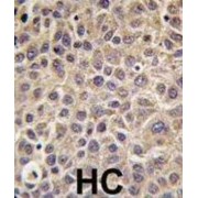 Myotubularin Related Protein 8 (MTMR8) Antibody