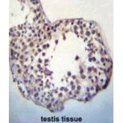 Putative Tyrosine-Protein Phosphatase TPTE (TPTEa) Antibody