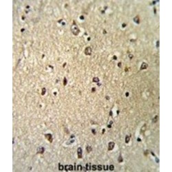 Importin Subunit Beta-1 (KPNB1) Antibody