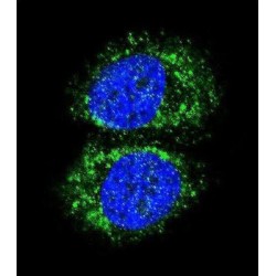 Transcription Factor p65 / NFKB3 (RELA) Antibody