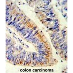 Transcription Factor p65 / NFKB3 (RELA) Antibody