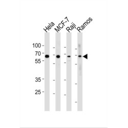 Transcription Factor p65 / NFKB3 (RELA) Antibody