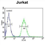 Delta-Aminolevulinic Acid Dehydratase (ALAD) Antibody