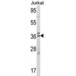 Delta-Aminolevulinic Acid Dehydratase (ALAD) Antibody