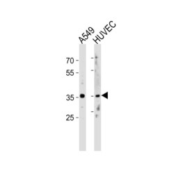 Homeobox Protein Hox-B5 (HOXB5) Antibody