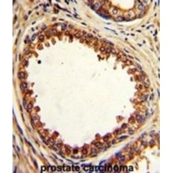 Protein Tyrosine Phosphatase Type IVA, Member 2 (PTP4A2) Antibody