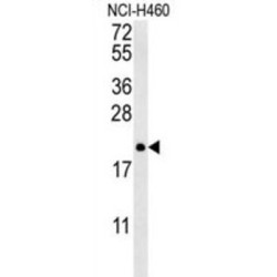 Protein Tyrosine Phosphatase Type IVA, Member 2 (PTP4A2) Antibody