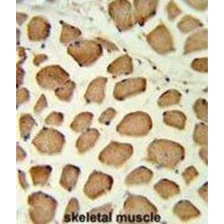 Protein Tyrosine Phosphatase, Non Receptor Type 11 (PTPN11) Antibody