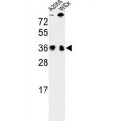 Serine/arginine-Rich Splicing Factor 1 (SFRS1) Antibody