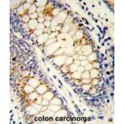 Serine/arginine-Rich Splicing Factor 1 (SFRS1) Antibody