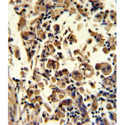 Superoxide Dismutase 3 (SOD3) Antibody