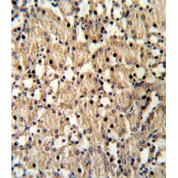 Paired Box Protein Pax-8 (PAX8) Antibody