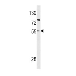 Paired Box Protein Pax-8 (PAX8) Antibody