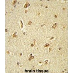 General Transcription Factor III (GTF2I) Antibody