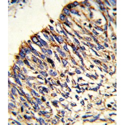 Trifunctional Enzyme Subunit Alpha, Mitochondrial (HADHA) Antibody