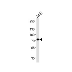 Trifunctional Enzyme Subunit Alpha, Mitochondrial (HADHA) Antibody