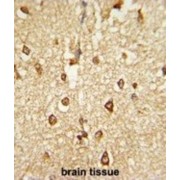 Homeobox Protein DLX-2 (DLX2) Antibody