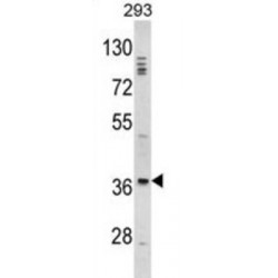 Homeobox Protein DLX-2 (DLX2) Antibody