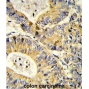 RS18 Antibody
