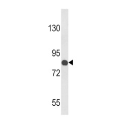 Cartilage Oligomeric Matrix Protein (COMP) Antibody