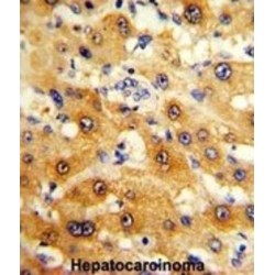 Ribosomal Protein S15 (RPS15) Antibody