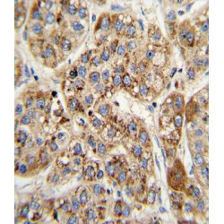 Methylcrotonoyl-CoA Carboxylase 2 (MCCC2) Antibody